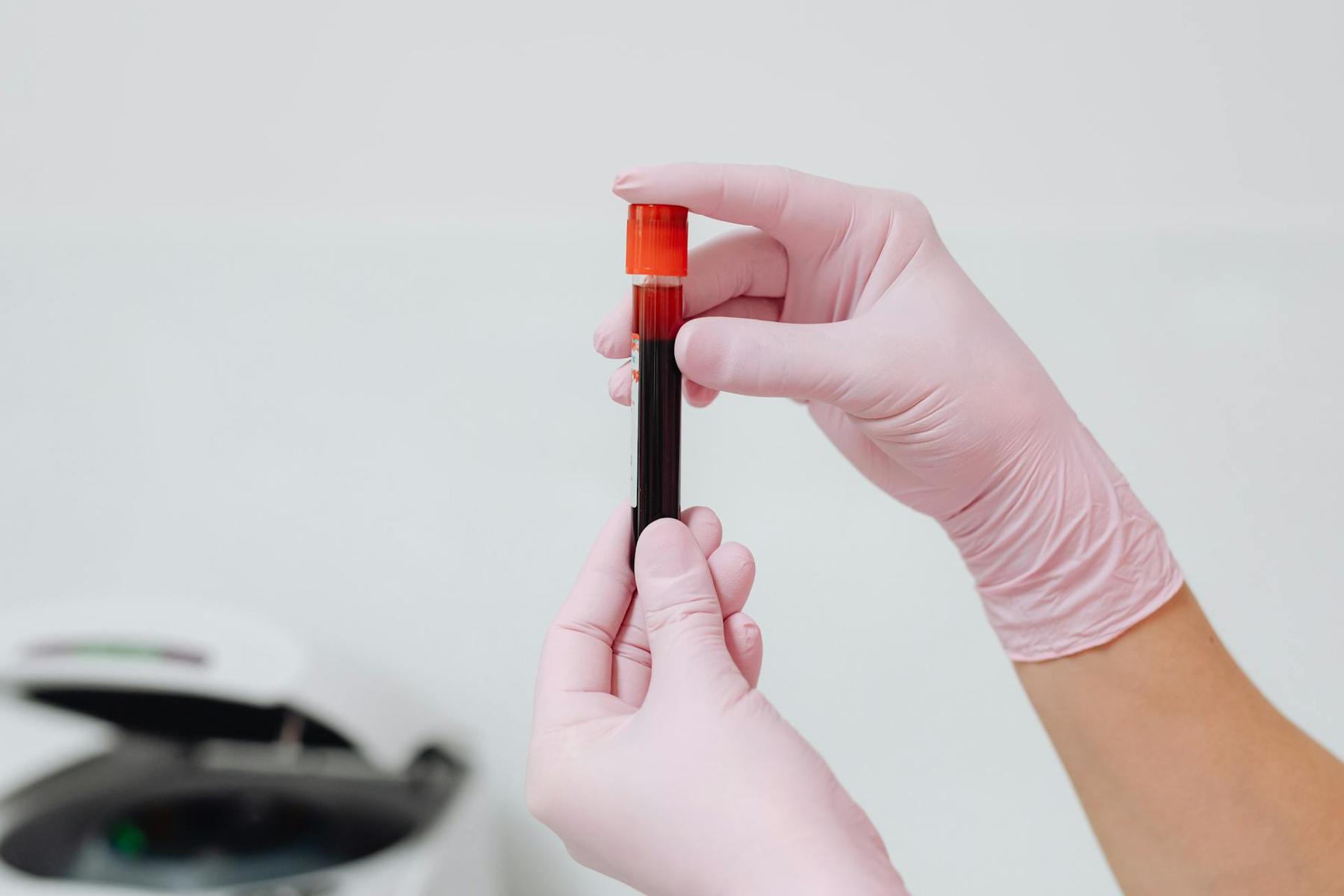 Close up of hands holding a vial containing blood for testing