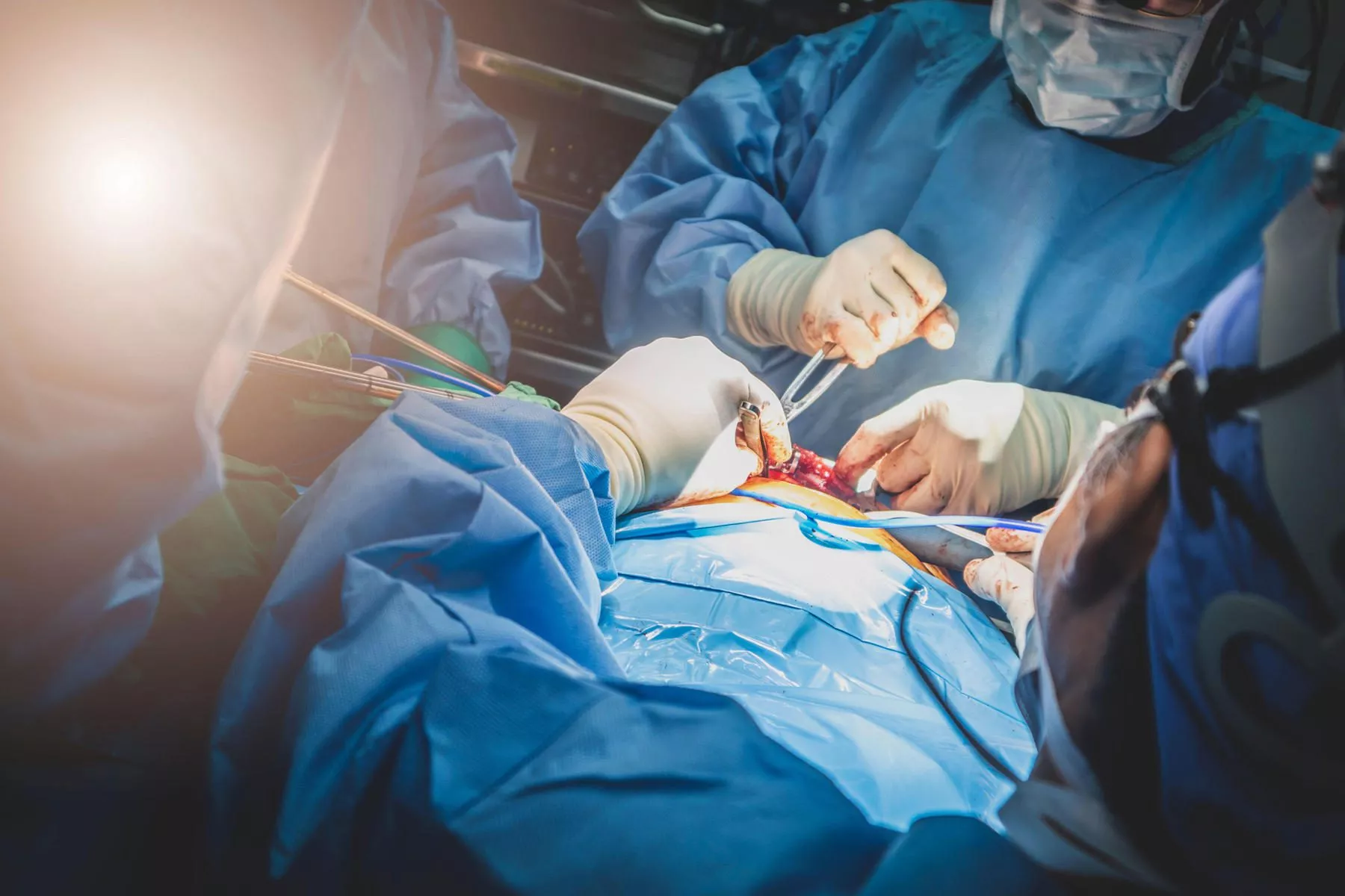 Surgeons performing a heart operation